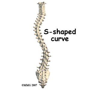 s shape spine